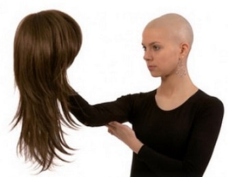 Alopecia (alopecie)
