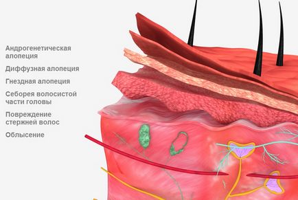 Laboratorul Amd Ekaterinburg - Trichologie