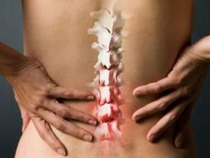 Boli ale coloanei vertebrale cauzează, simptome, prevenire
