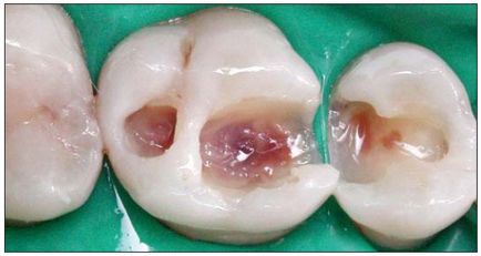 Dental-revü, cikkek, terápiás besorolás hasznosítási technikák