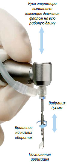 Sistemul endodontic saf