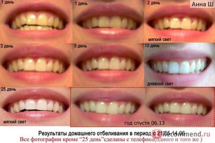 Гель для відбілювання зубів discus dental usa nite white acp - «мій особистий вибір для домашнього