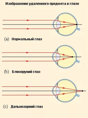 Optica geometrică a ochilor și a ochelarilor