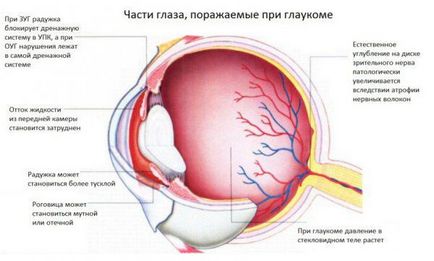 Очні краплі від глаукоми і очного тиску список і назви