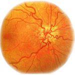 Picături oculare din glaucom și lista de presiune a ochilor și numele