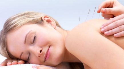 Acupunctura la toate (distonie vegetativ-vasculară)