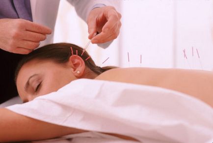 Acupunctura la toate (distonie vegetativ-vasculară)