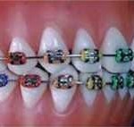 Reimplantácíóhoz, Gauz „fogászati №3» g (klinika) Malocclusion, Gauz „fogászati №3» g