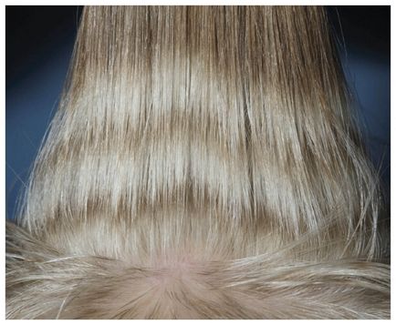 Які причини призводять до розвитку депігментації волосся