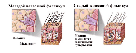 Ce cauzează depigmentarea părului?