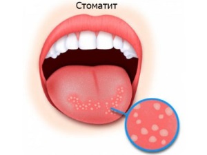 Cum să luați în mod adecvat peroxidul de hidrogen în interior