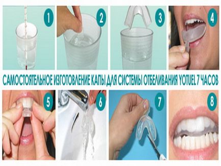 Капи для відбілювання зубів плюси і мінуси фото і відео