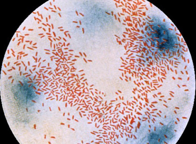 Tratamentul și prevenirea infecțiilor cu hemofilie