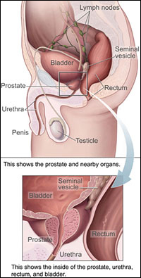 Tratamentul prostatitei cronice, acute și stagnante, prețuri favorabile în St. Petersburg (SPB)