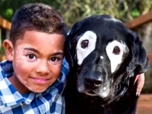 Tratamentul vitiligo la copii