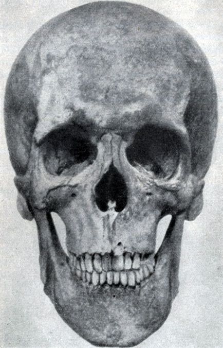 Facial Craniu 1958 mecanic n