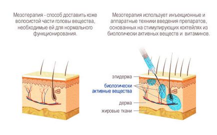 Mezoterapia pentru păr - indicații și contraindicații, prețuri și recenzii, procedura la domiciliu