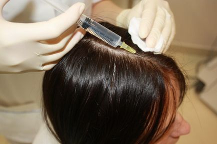 Mezoterapia pentru păr - indicații și contraindicații, prețuri și recenzii, procedura la domiciliu
