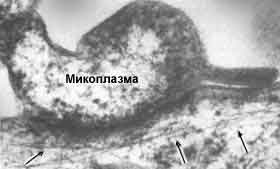 Mycoplasmosis, hatékony kezelése mycoplasmosis a RANS SRI - Edis mézzel - (vizsgálni