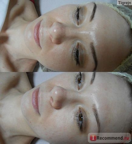 Myostrukturny orală facială molodilnye masaj - 