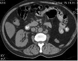 Mtskt cavitatea abdominala, avantajele metodei