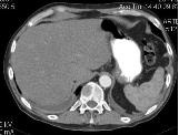 Mtskt cavitatea abdominala, avantajele metodei