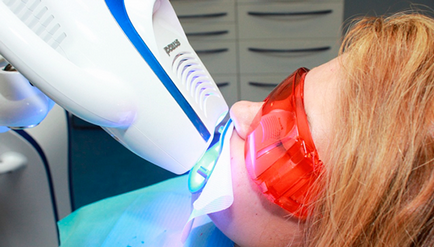 Albirea dintilor l Sfaturi si reguli de baza l Medicul dentist