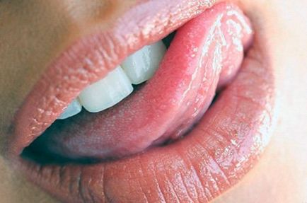Papilloma în gură prezintă tratament la copii și adulți