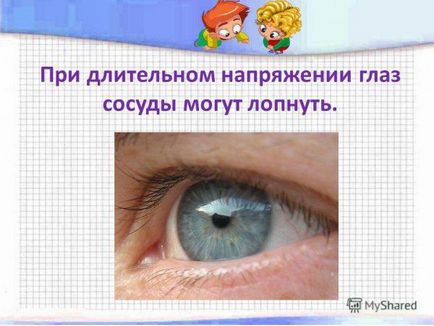 Чому лопаються судини в очах що робити, причини, ніж лікувати, якщо у дорослого і дитини