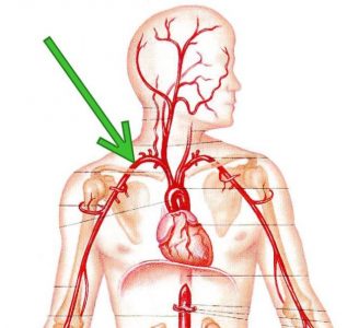 Підключична артерія і її гілки що це таке
