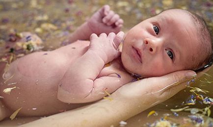 Пітниця у новонароджених як виглядає і як позбутися від висипки на обличчі і шиї