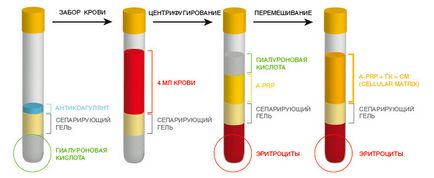 Utilizarea plasmei bogate în trombocite în diferite domenii de medicină