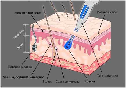 Різні типи голок і сфера їх застосування