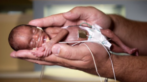 Un copil a supraviețuit unui avort