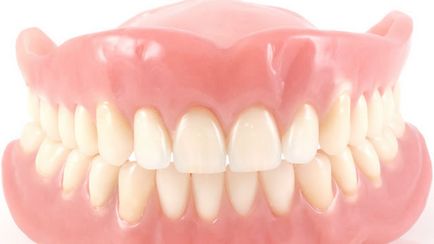 Знімні зубні протези - приватна стоматологічна клініка dali-dent