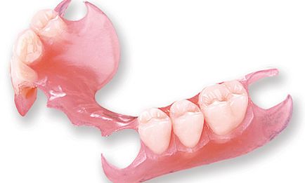 Знімні зубні протези - приватна стоматологічна клініка dali-dent