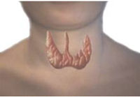 Glandă tiroidă