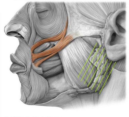 Nyálmirigyek ultrahanggal (előadás diagnostere)