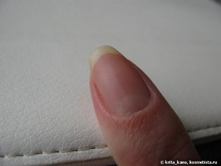 Порятунок нігтів з nail tek
