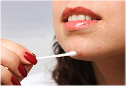 Streptocidul din acnee alege unguent, pulbere sau tablete
