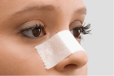 Tactica de a trata leziunile nasului este metoda pe care o alegem