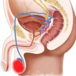 Teratomul provoacă dezvoltarea, simptomele, diagnosticul, tratamentul eficient de toate tipurile