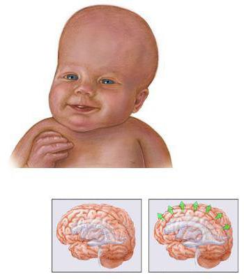 agyi ultrahang gyerekeknek csinálni, amely azt mutatja,