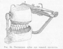 Tipuri de stomatologie, stomatologie ortopedică