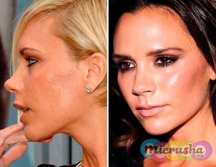 Victoria Beckham (victoria Beckham) fără make-up și photoshop