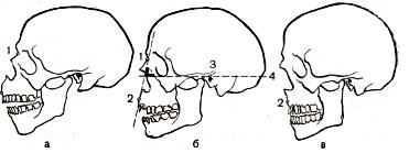Caracteristicile craniului facial - proporțiile feței unei persoane și modificările acesteia în funcție de vârstă