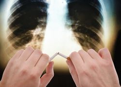 COPD - a várható élettartam