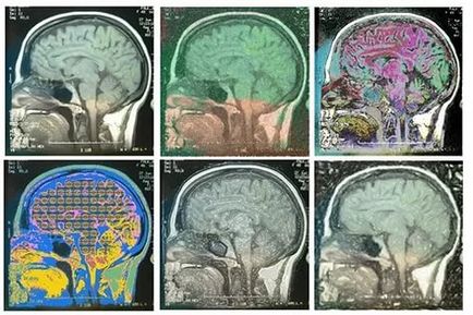 Miért egy MRI kontraszt amely kontrasztanyagok, azaz a dinamikus kontraszt fokozó
