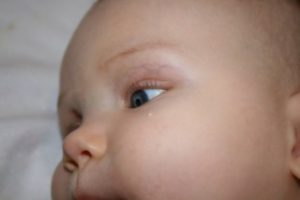 Жировик у немовляти - чому з'являються і що необхідно робити