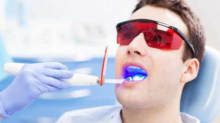 Зуби курця згубні наслідки шкідливої ​​звички